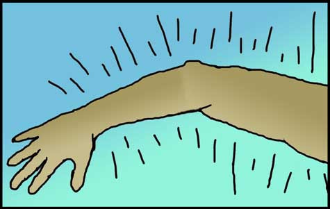 MS-einkenni: Skyntruflanir